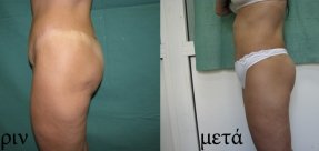 anorthosi-miron-3a_thumb
