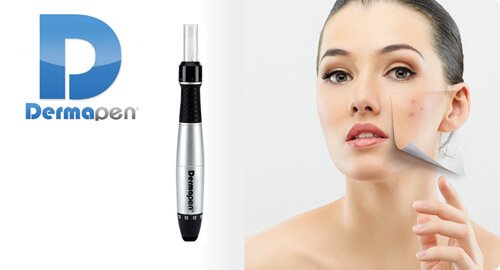 Mesotherapy and Dermapen